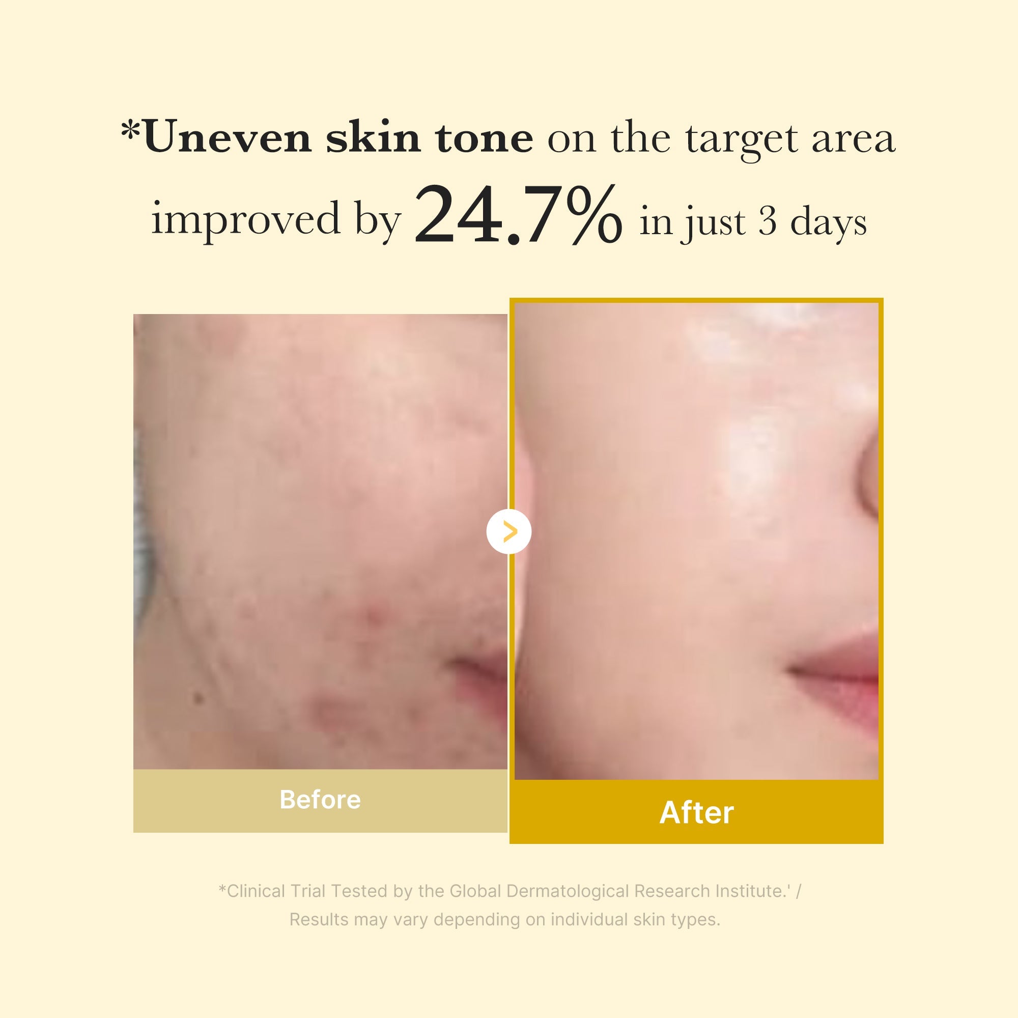 SeoulMori© Kojic Acid Tumeric Peel Off Mask