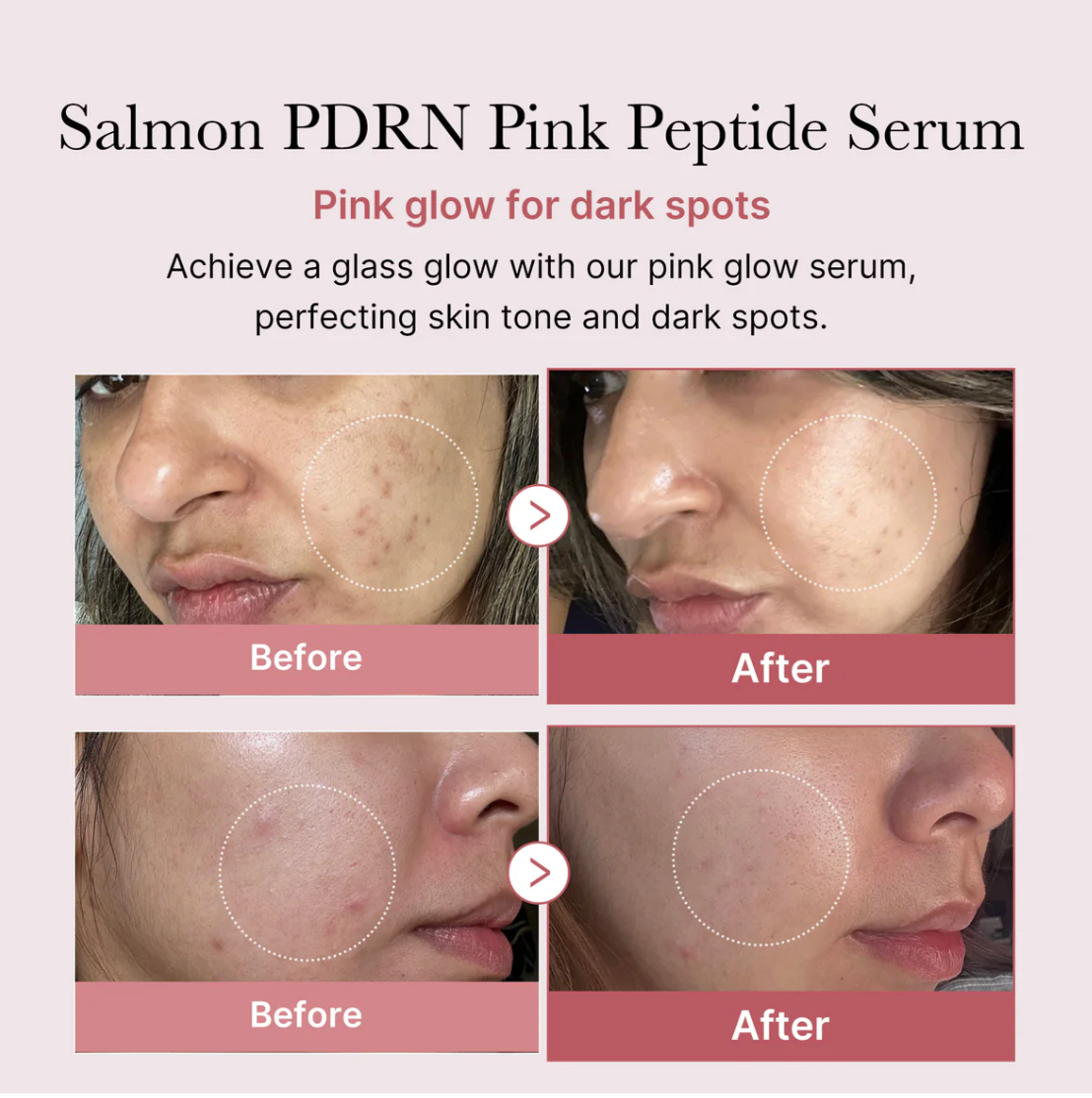 PDRN Pink Peptide Serum