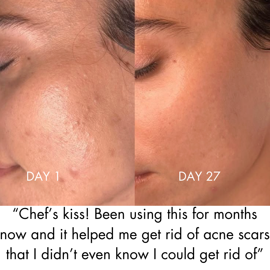 SeoulMori© Collagen Glass Mask